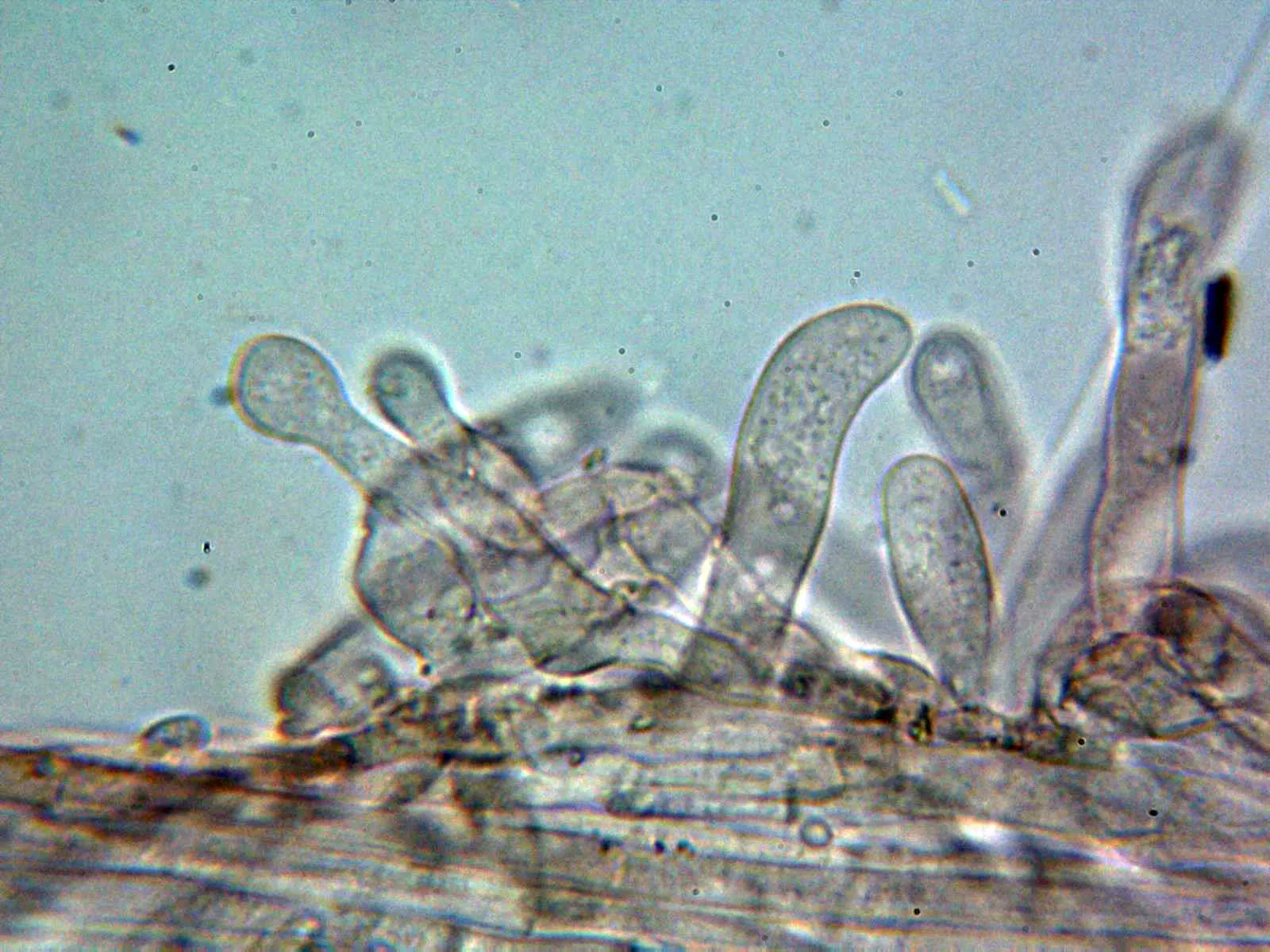 Microscopía de Pholiotina dasypus - 10 - Caulocistidios 1